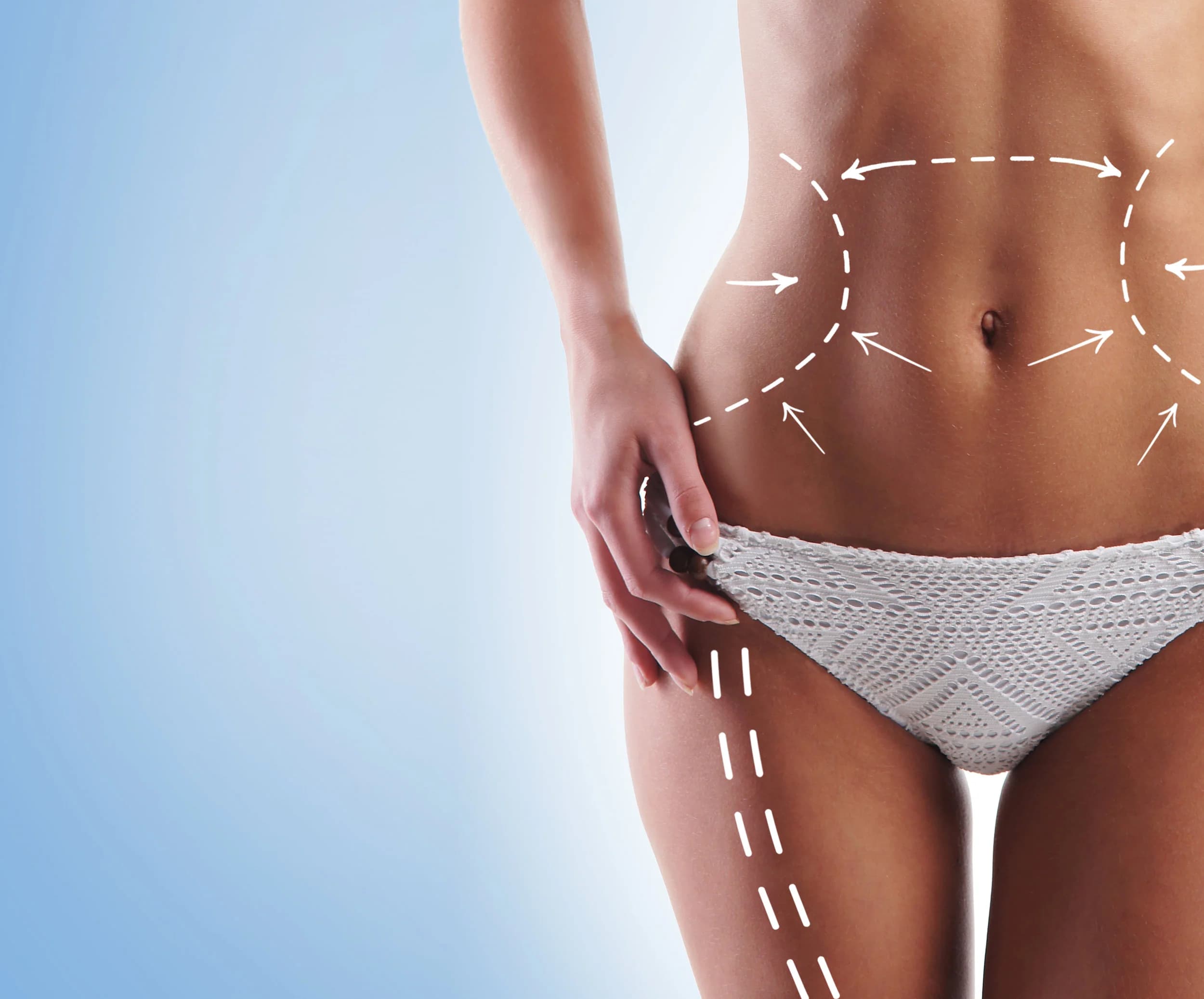 VIP Lipoline DUO device